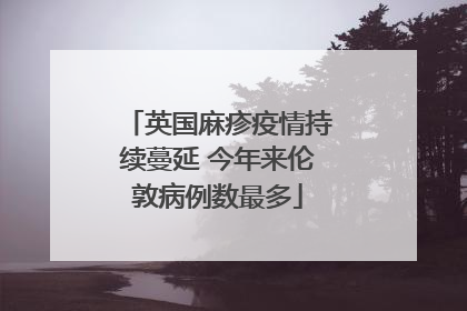 英国麻疹疫情持续蔓延 今年来伦敦病例数最多